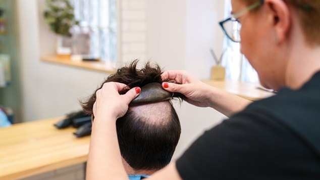 Profissional aplica a prótese capilar no couro cabeludo de seu cliente